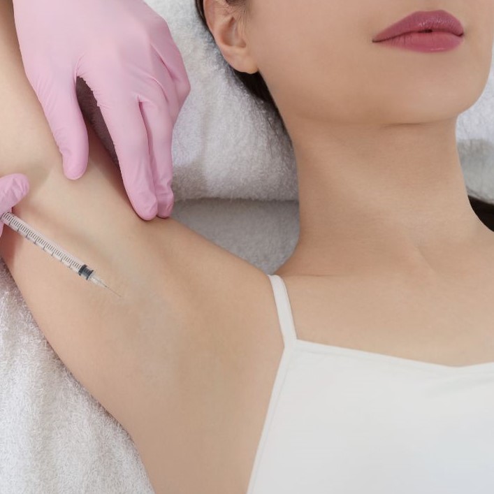 Patient receiving Hyperhidrosis treatment at London Dental Arts Clinic to reduce excessive sweating.