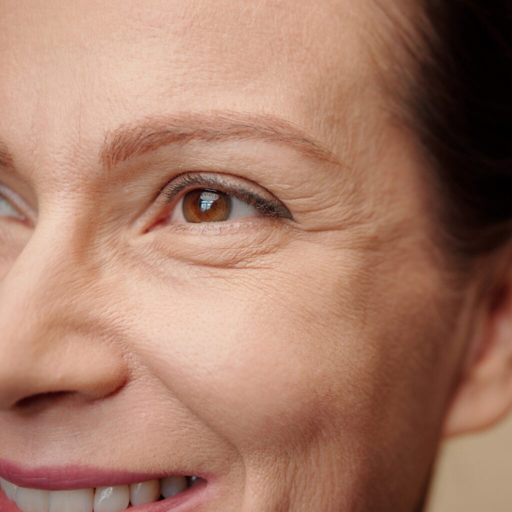 NCTF Skin Booster in Forest Hill